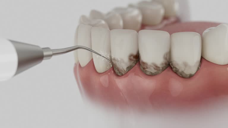 Reliable Dental Implants contractor in Icard, NC by Smile Center Dentistry